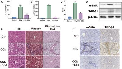 Saikosaponin d Alleviates Liver Fibrosis by Negatively Regulating the ROS/NLRP3 Inflammasome Through Activating the ERβ Pathway